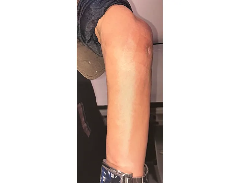 13 after
