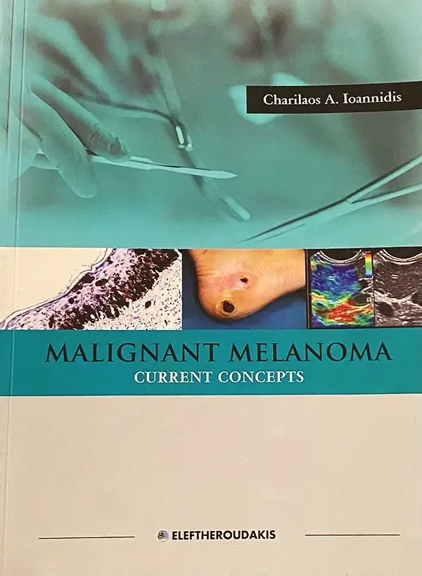 Malignant Melanoma Current Concepts Malignant Melanoma Current Concepts