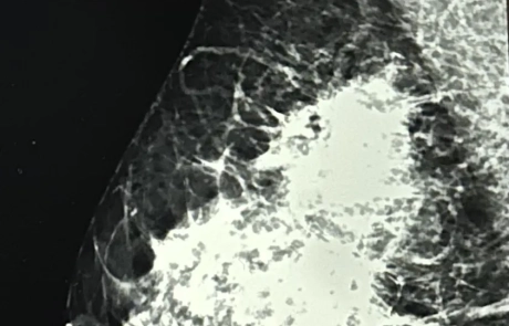 02 Clinical Case