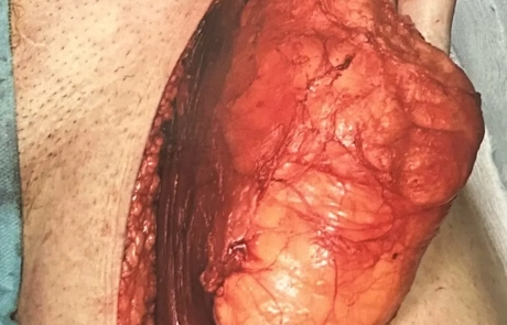 03 Clinical Case