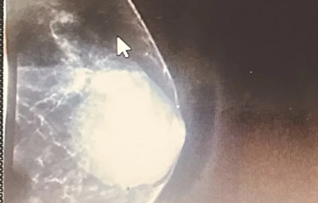 04 Clinical Case