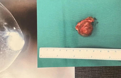 05 Clinical Case