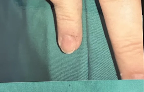 06 Clinical Case