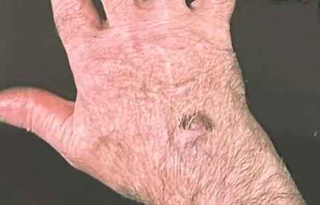 07 Clinical Case