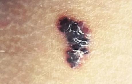 08 Clinical Case