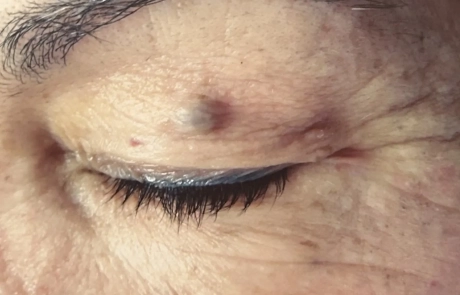 10 Clinical Case