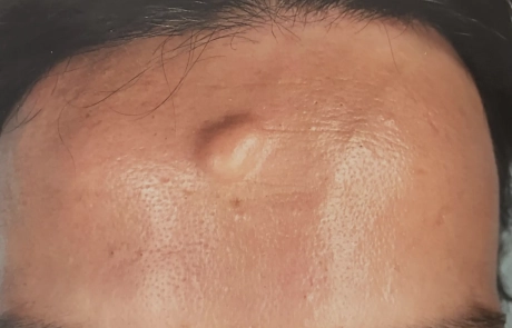 11 Clinical Case