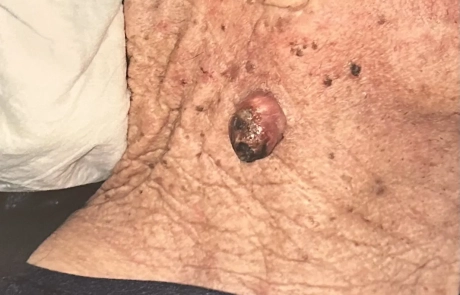 12 Clinical Case