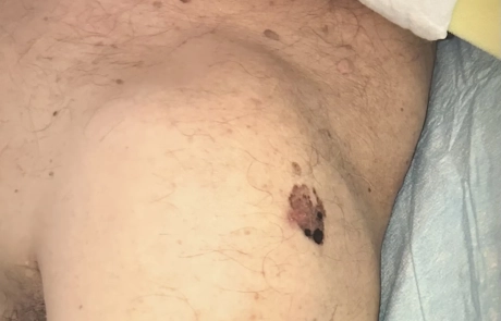 13 Clinical Case