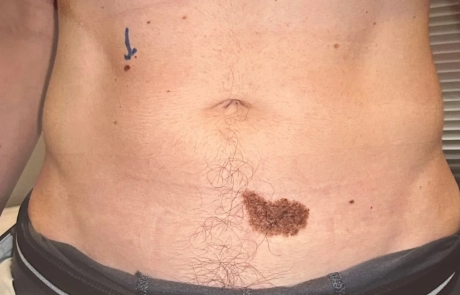 14 Clinical Case