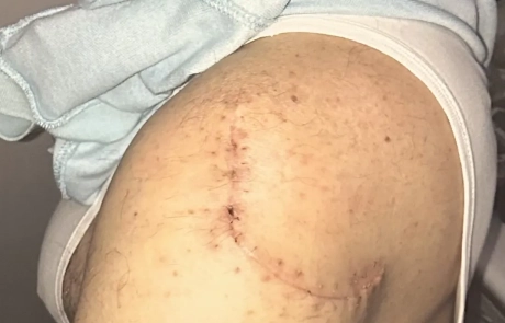 15 Clinical Case
