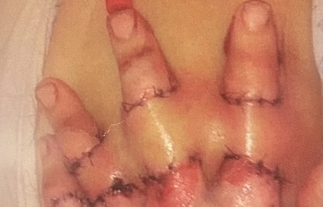 16 Clinical Case