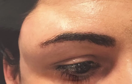 17 Clinical Case