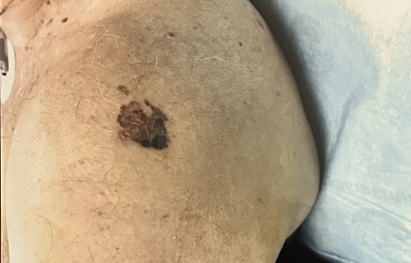 18 Clinical Case