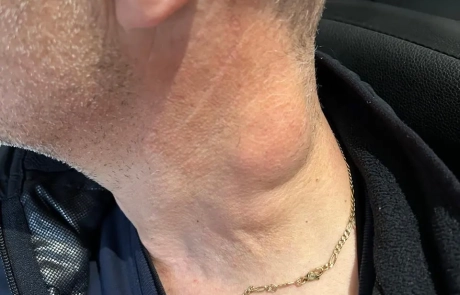 19 Clinical Case