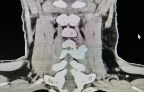 19 Clinical Case