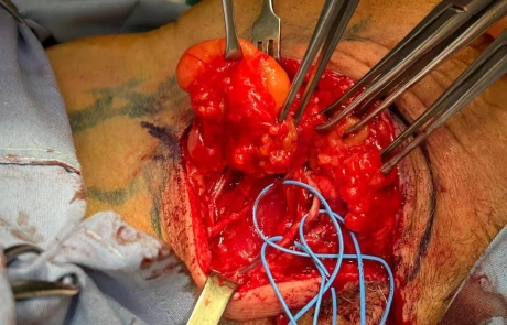 19 Clinical Case