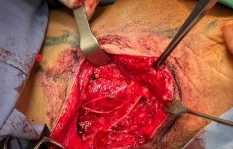 19 Clinical Case