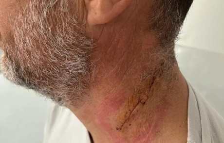 19 Clinical Case